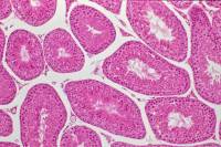 CT Testicule x40